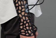 osteoid-a-design[1]